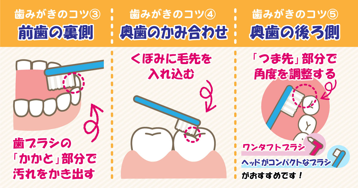 箕面市の歯医者なら痛みを少なく安心して通える尾川歯科医院