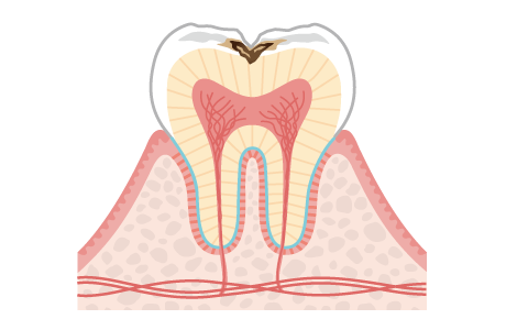 箕面市の歯医者なら痛みを少なく安心して通える尾川歯科医院
