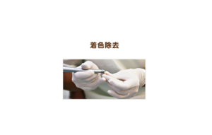 着色除去