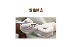 着色除去