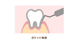 ポケット検査