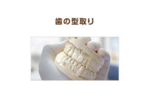 歯の型取り