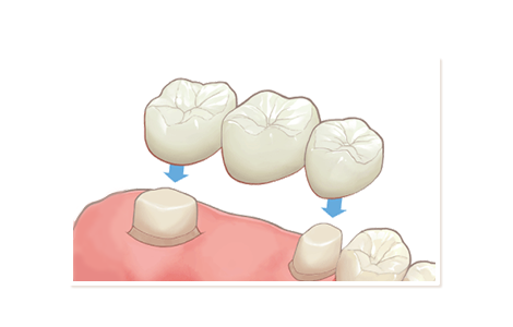 箕面市の歯医者なら痛みを少なく安心して通える尾川歯科医院