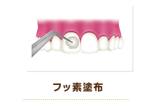 箕面市の歯医者なら痛みを少なく安心して通える尾川歯科医院