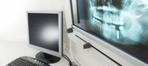 歯のレントゲン画像