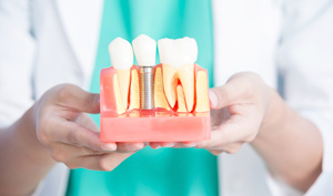 箕面市の歯医者なら痛みを少なく安心して通える尾川歯科医院