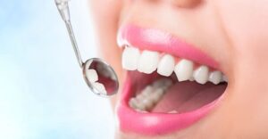 歯並びの良い女性