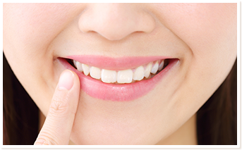 オフィスホワイトニングする女性