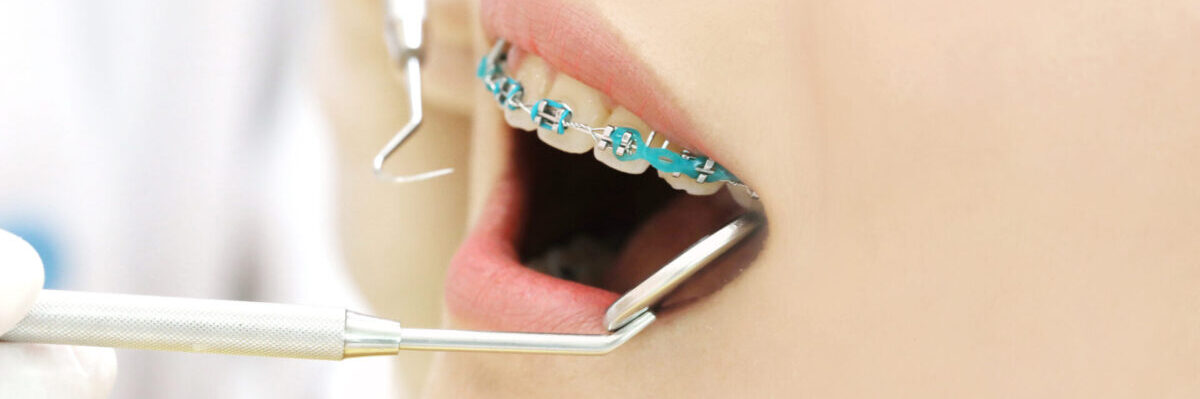 箕面市の歯医者なら痛みを少なく安心して通える尾川歯科医院