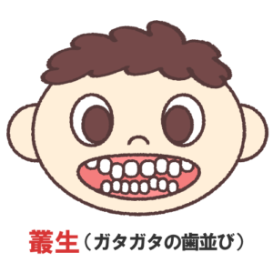 ガタガタの歯並び