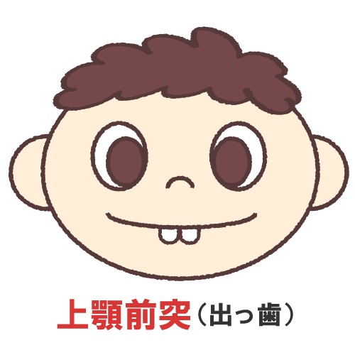 出っ歯のイラスト