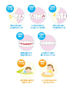 矯正治療は、このようなお子様におすすめ。