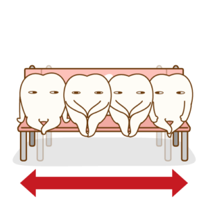 歯の重なりを改善するための装置