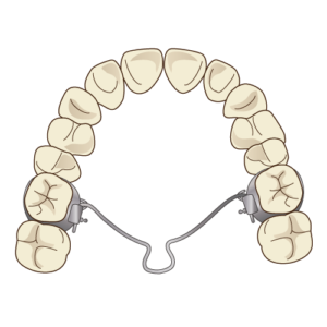 ワイヤーでつながれた歯のイラスト