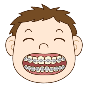 ワイヤー矯正している男の子のイラスト