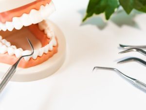 歯周病のイメージ