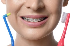 矯正している女性と歯ブラシ