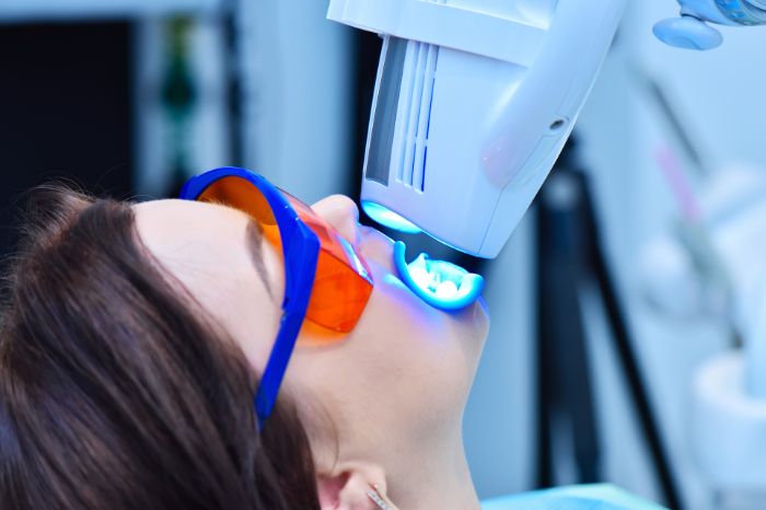 オフィスホワイトニング