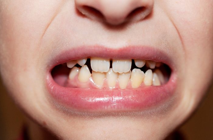 箕面市の歯医者なら痛みを少なく安心して通える尾川歯科医院