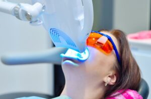 オフィスホワイトニング