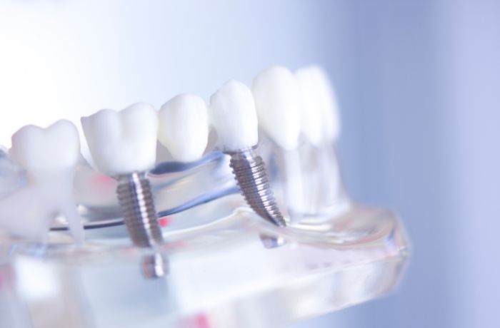 箕面市の歯医者なら痛みを少なく安心して通える尾川歯科医院